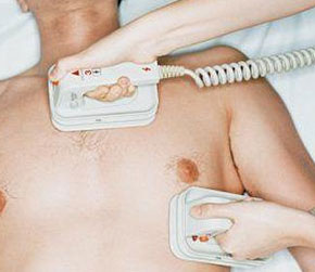 Heart Defibrillator
